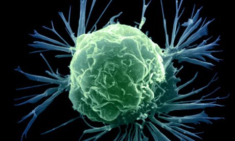 breast-cancer-cell