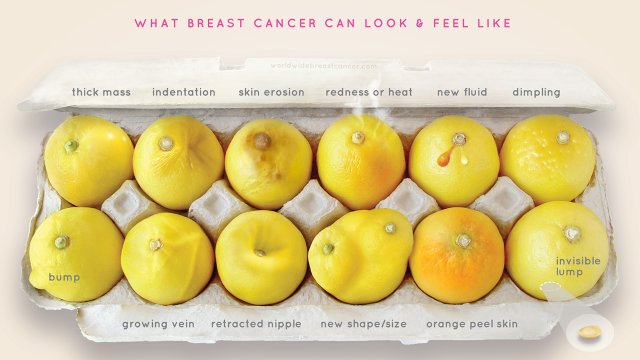what_breast_cancer_looks_li